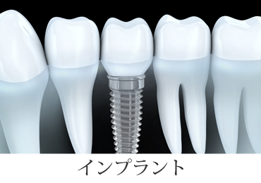 インプラント